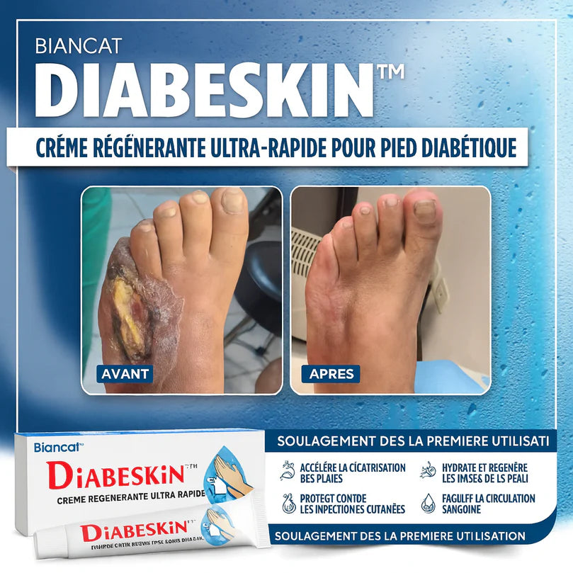 DiabeSkin™ Crème Régénérante Ultra-Rapide | Cicatrise les plaies diabétiques en 3 jours, sans antibiotique!