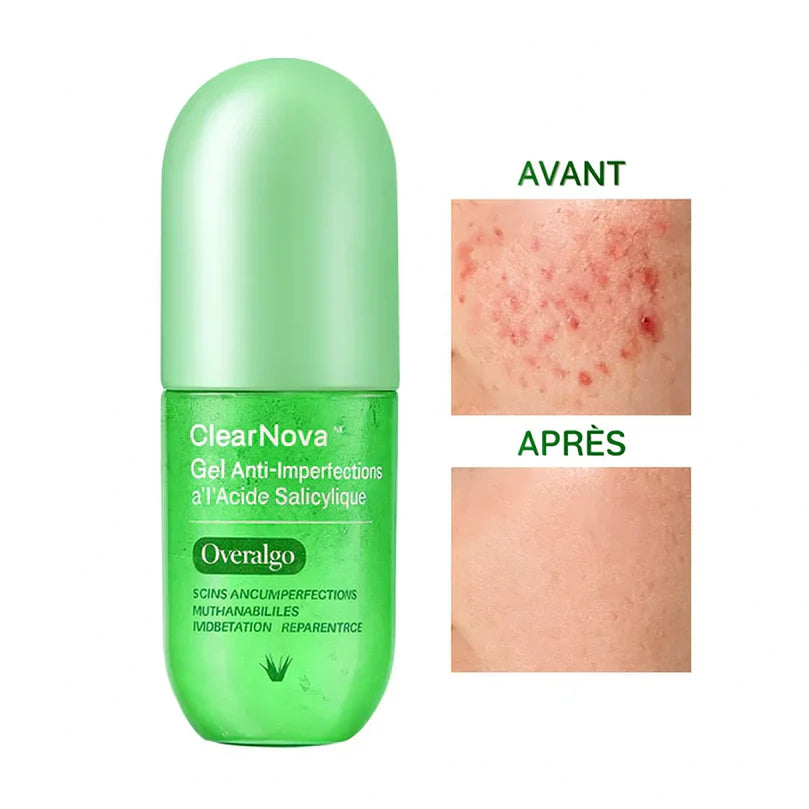 ClearNova™ Gel Anti-Imperfections à l’Acide Salicylique | Efface boutons et taches brunes en 48h chrono!
