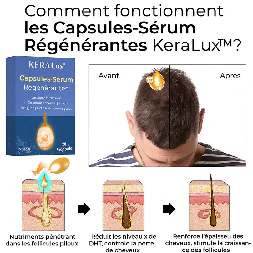 KeraLux™ Capsules-Sérum Régénérantes | Répare et Fait Repousser les Cheveux Abîmés en 14 Jours!