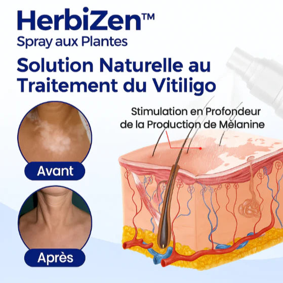 HerbiZen™ Spray aux Plantes | Élimine les taches de vitiligo et unifie votre teint en 10 minutes!