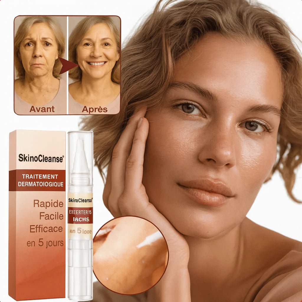 SkinoCleanse™ Traitement Dermatologique | Élimine Verrues, Taches et Grains de Beauté à la Racine en 3 Jours – Sans Scalpel, Sans Douleur!