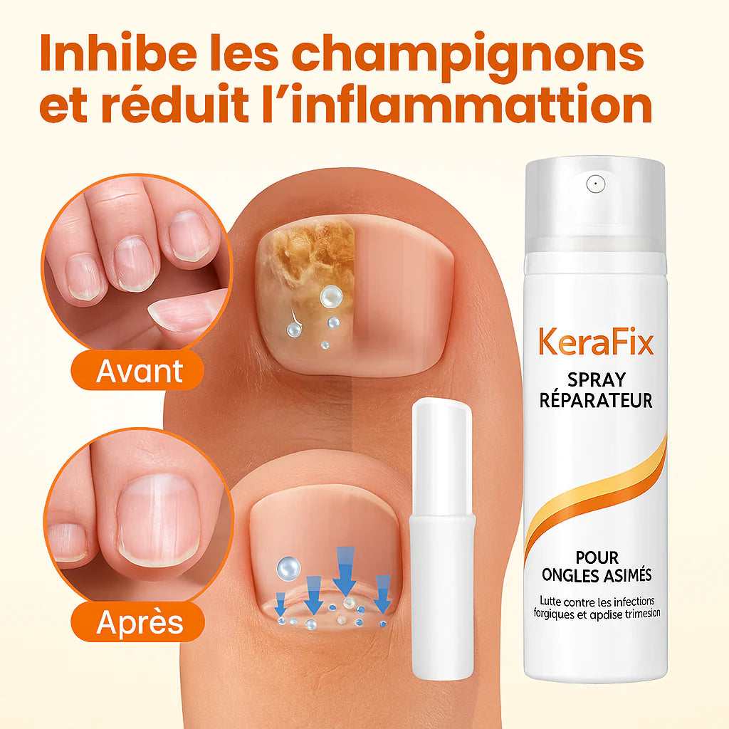KeraFix™ Spray Réparateur pour Ongles Abîmés | Renforce, lisse et reconstruit les ongles en 7 jours!